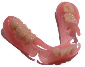 FlexStar Lower Partial Denture